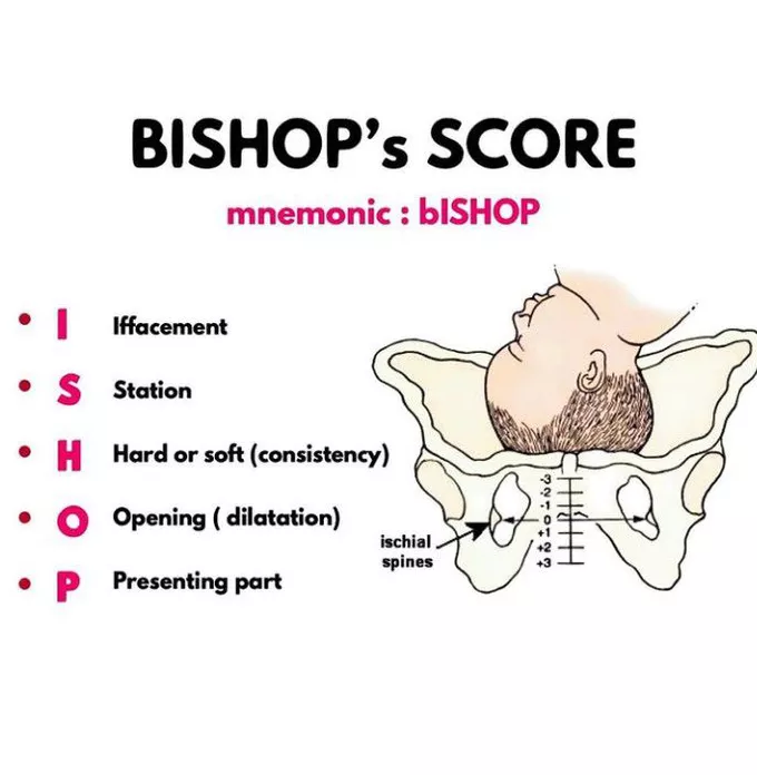 Bishop Score Calculator